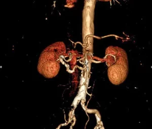 kt-angiografiya-2